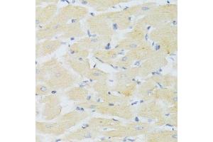 Immunohistochemistry of paraffin-embedded mouse heart using CXCR3 Antibody. (CXCR3 Antikörper)