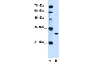 WB Suggested Anti-HFE Antibody Titration:  0. (HFE Antikörper  (C-Term))