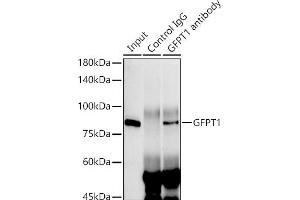 Immunoprecipitation analysis of 300 μg extracts of HeLa cells using 3 μg GFPT1 antibody (ABIN7267430). (GFPT1 Antikörper)