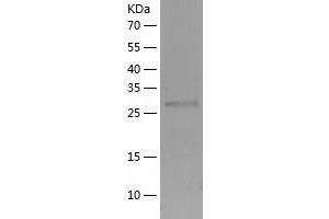 TTC33 Protein (AA 1-262) (His tag)