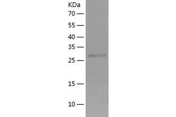 TTC33 Protein (AA 1-262) (His tag)