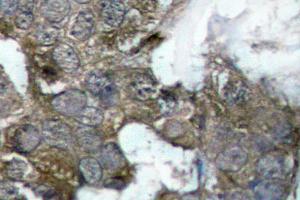 Image no. 2 for anti-Nuclear Factor of kappa Light Polypeptide Gene Enhancer in B-Cells Inhibitor, alpha (NFKBIA) antibody (ABIN265483) (NFKBIA Antikörper)