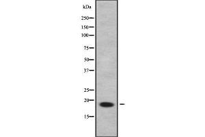 Western blot analysis of C9orf23 using LOVO whole cell lysates (RPP25L Antikörper  (C-Term))