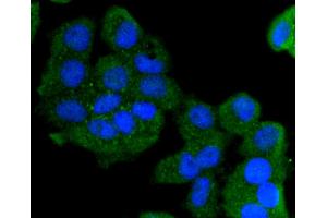 Immunofluorescence (Cultured Cells) (IF (cc)) image for anti-Keratin 13 (KRT13) antibody (ABIN5557438)