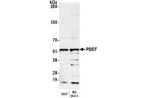 Western Blotting (WB) image for anti-Nicotinamide phosphoribosyltransferase (NAMPT) (AA 400-450) antibody (ABIN7454619)
