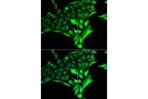 Immunofluorescence analysis of MCF-7 cell using PYGB antibody. (PYGB Antikörper)