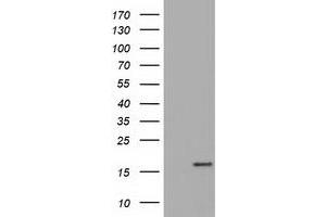 HEK293T cells were transfected with the pCMV6-ENTRY control (Left lane) or pCMV6-ENTRY TTC32 (Right lane) cDNA for 48 hrs and lysed. (TTC32 Antikörper)