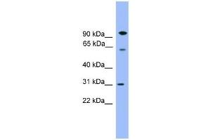 Western Blot showing CPNE6 antibody used at a concentration of 1-2 ug/ml to detect its target protein.