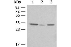 Western blot analysis of OP9 HepG2 and NIH/3T3 cell lysates using CNPY3 Polyclonal Antibody at dilution of 1:400 (TNRC5 Antikörper)