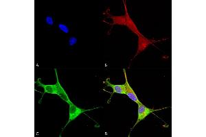 Immunocytochemistry (ICC) image for anti-ATPase, Cu++ Transporting, alpha Polypeptide (ATP7A) (AA 42-61) antibody (Atto 488) (ABIN2485182)