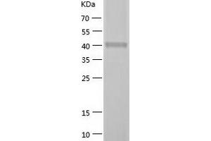 DGKH Protein (AA 1-187) (His-IF2DI Tag)