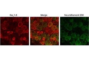 Immunohistochemistry (IHC) image for anti-Sodium Channel, Voltage-Gated, Type X, alpha Subunit (SCN10A) (AA 1943-1956), (Intracellular) antibody (ABIN7043653)