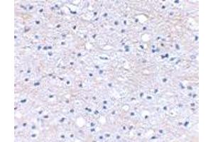 Immunohistochemical staining of human brain tissue using HAPLN2 polyclonal antibody  at 2. (HAPLN2 Antikörper  (Internal Region))