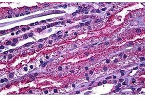 Human Kidney: Formalin-Fixed, Paraffin-Embedded (FFPE) (ABCC4 Antikörper  (AA 1-110))