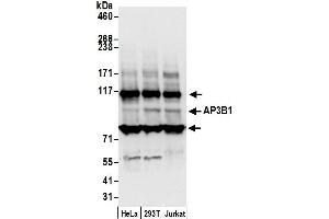 anti-Adaptor-Related Protein Complex 3, beta 1 Subunit (AP3B1) (AA 725-775) antibody