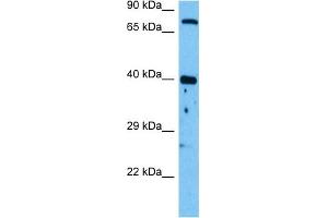 Western Blotting (WB) image for anti-Wingless-Type MMTV Integration Site Family, Member 1 (WNT1) (Middle Region) antibody (ABIN2779465)