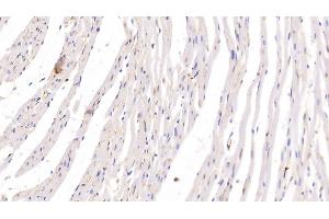 Detection of ADPN in Rat Heart Tissue using Monoclonal Antibody to Adiponectin (ADPN) (ADIPOQ Antikörper  (AA 111-244))