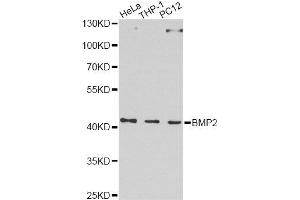 Western blot analysis of extracts of various cell lines, using BMP2 Antibody. (BMP2 Antikörper  (AA 283-396))