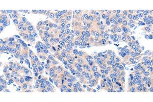Immunohistochemistry (Paraffin-embedded Sections) (IHC (p)) image for anti-Potassium Voltage-Gated Channel, Subfamily H (Eag-Related), Member 8 (KCNH8) antibody (ABIN7242203)