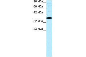 WB Suggested Anti-NR4A1 Antibody Titration:  0. (NR4A1 Antikörper  (N-Term))