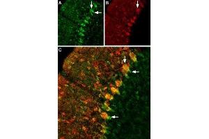 Expression of GABATR in rat cerebellumImmunohistochemical staining of rat cerebellum using Anti-GABA Transporter 1  (extracellular) Antibody (ABIN7043178, ABIN7044459 and ABIN7044460), (1:200). (GABA Transporter 1 (GAT1) Peptid)