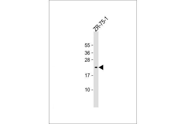 Vasopressin Antikörper  (AA 102-129)