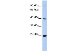 WB Suggested Anti-SSBP4 Antibody Titration:  0. (SSBP4 Antikörper  (Middle Region))