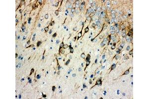 IHC-P: AChR antibody testing of rat brain tissue