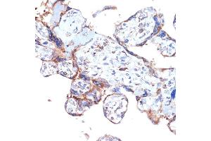 Immunohistochemistry of paraffin-embedded human placenta using ER Rabbit mAb (ABIN7266941) at dilution of 1:100 (40x lens). (ERAP1 Antikörper)