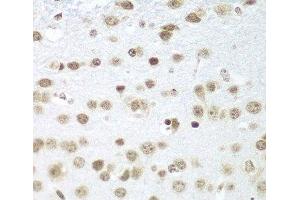 Immunohistochemistry of paraffin-embedded Mouse brain using SAP18 Polyclonal Antibody at dilution of 1:100 (40x lens).