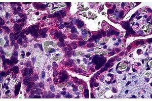 Human Placenta: Formalin-Fixed, Paraffin-Embedded (FFPE) (S1PR3 Antikörper)