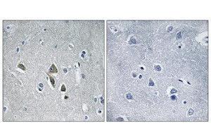 Immunohistochemistry (IHC) image for anti-Ornithine Decarboxylase Antizyme 1 (OAZ1) (N-Term) antibody (ABIN1851761) (OAZ1 Antikörper  (N-Term))