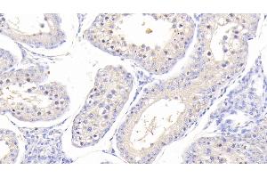 Immunohistochemistry (IHC) image for anti-Fatty Acid Binding Protein 3, Muscle and Heart (FABP3) (AA 1-133) antibody (ABIN7443005)