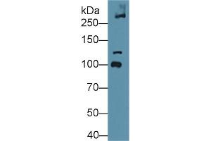 Detection of COL6a3 in Mouse Bladder lysate using Polyclonal Antibody to Collagen Type VI Alpha 3 (COL6a3) (COL6a3 Antikörper  (AA 2009-2205))
