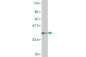 Western Blot detection against Immunogen (36. (Nucleostemin Antikörper  (AA 328-427))
