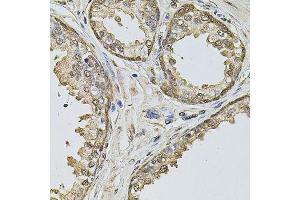 Immunohistochemistry of paraffin-embedded human prostate using CCNA2 antibody. (Cyclin A Antikörper  (AA 1-200))