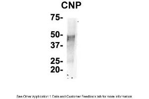 IP Suggested Anti-CNP Antibody    Positive Control:  NT2 CELL/BRAIN TISSUE (Cnpase Antikörper  (N-Term))