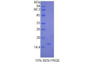 SDS-PAGE analysis of Human Immunoglobulin G4 Protein.