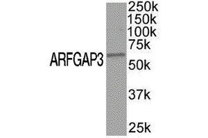 Western Blotting (WB) image for anti-ADP-Ribosylation Factor GTPase Activating Protein 3 (ARFGAP3) antibody (ABIN2477490)