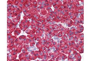 Anti-MDA5 antibody IHC of human pancreas. (IFIH1 Antikörper  (C-Term))