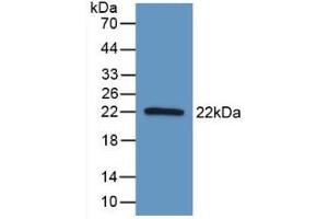 Detection of Recombinant AATK, Human using Polyclonal Antibody to Apoptosis Associated Tyrosine Kinase (AATK)