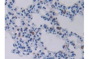 IHC-P analysis of Mouse Lung Tissue, with DAB staining. (CHI3L1 Antikörper  (AA 112-356))