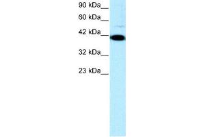 WB Suggested Anti-ZFP1 Antibody Titration: 0. (Zfp-1 Antikörper  (N-Term))