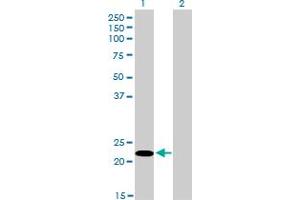 Western Blotting (WB) image for anti-serine/arginine-Rich Splicing Factor 10 (SRSF10) (AA 1-101) antibody (ABIN599153) (SRSF10 Antikörper  (AA 1-101))
