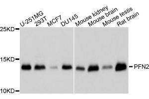 Western blot analysis of extracts of various cell lines, using PFN2 antibody (ABIN5995368) at 1/1000 dilution. (PFN2 Antikörper)