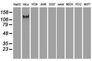 Image no. 6 for anti-L1 Cell Adhesion Molecule (L1CAM) antibody (ABIN1499089) (L1CAM Antikörper)