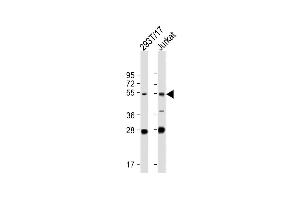 All lanes : Anti-FOXN3 Antibody (C-term) at 1:2000 dilution Lane 1: 293T/17 whole cell lysate Lane 2: Jurkat whole cell lysate Lysates/proteins at 20 μg per lane.