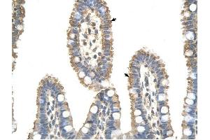 ANAPC7 antibody was used for immunohistochemistry at a concentration of 4-8 ug/ml to stain Epithelial cells of intestinal villus (arrows) in Human Intestine. (ANAPC7 Antikörper  (C-Term))