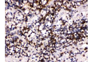 Anti- CD22 Picoband antibody, IHC(P) IHC(P): Human Tonsil Tissue