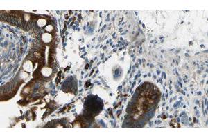 ABIN6269178 at 1/100 staining Mouse intestine tissue by IHC-P. (GABA-RB Antikörper)